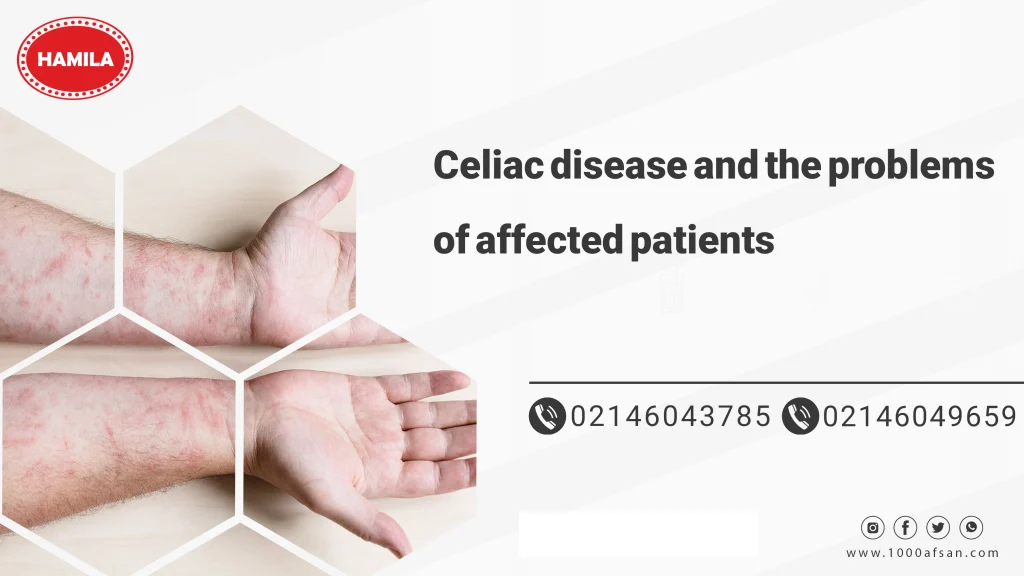 Celiac disease and the problems of affected patients